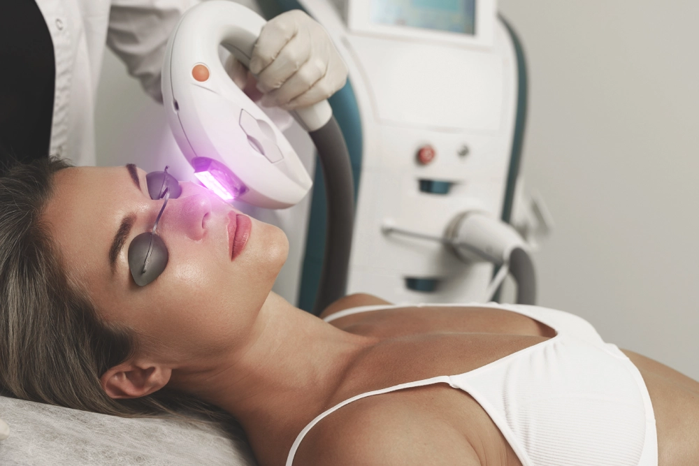 IPL Treatment 1