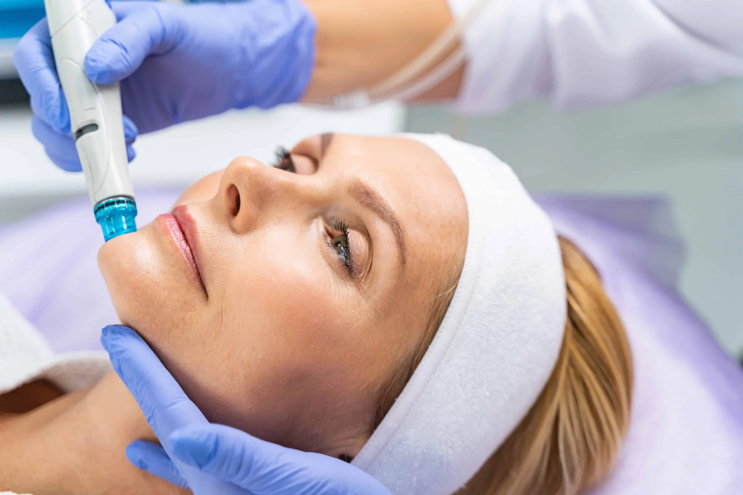 hydrodermabrasion benefits 1 scaled